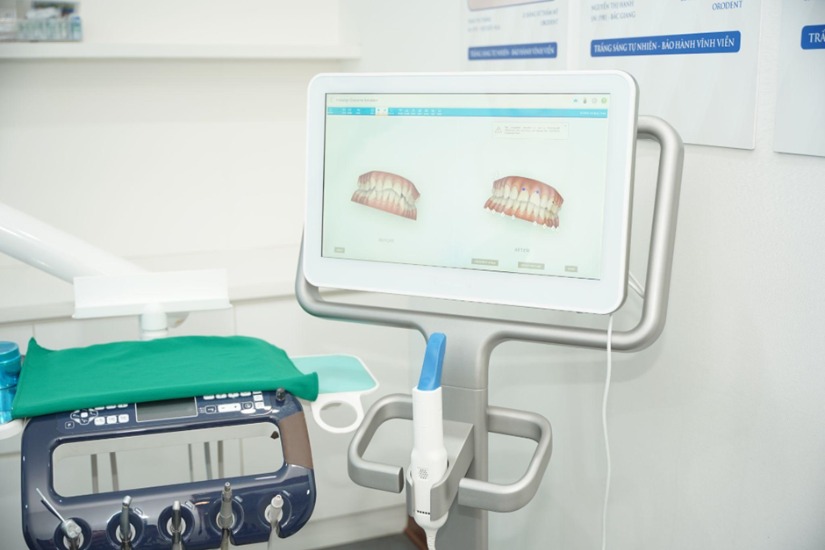 Công nghệ quét 3D chuẩn xác