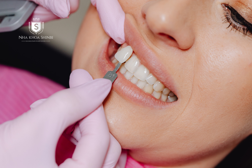 Khi răng sứ bị rơi, bạn cần đến gặp bác sĩ nha khoa để xử lý