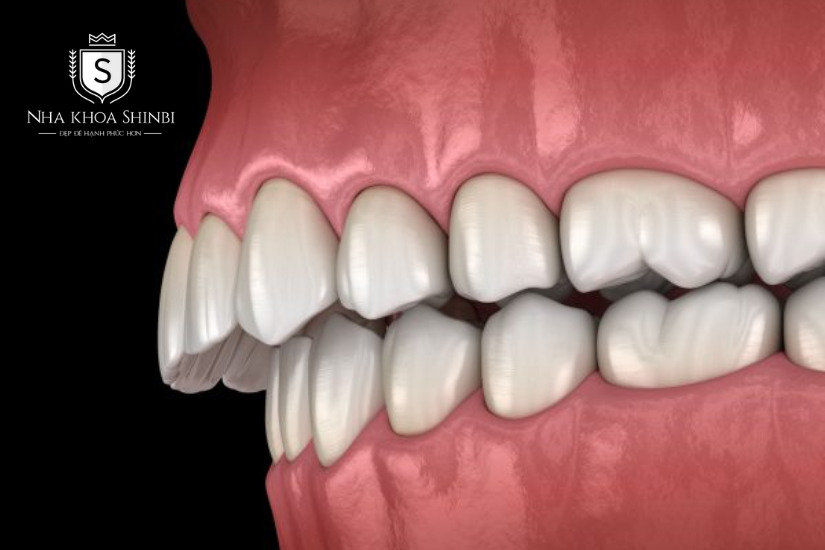 Nắm rõ tình trạng răng miệng và biện pháp điều trị phù hợp