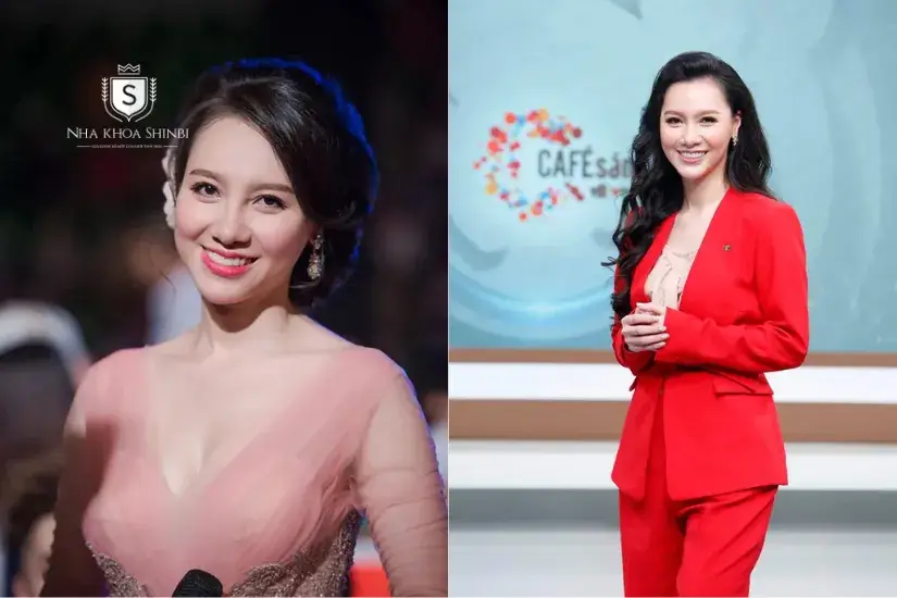 MC Minh Hà bọc răng sứ