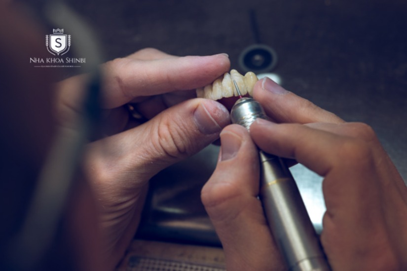 Quá trình mài răng không đúng kỹ thuật