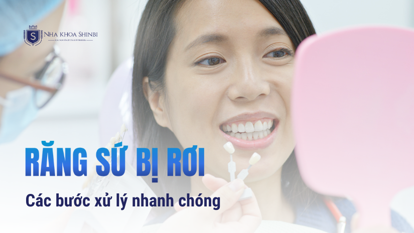 Cần đến tìm gặp bác sĩ để nhanh chóng để xử lý tình trạng răng sứ bị rơi ra