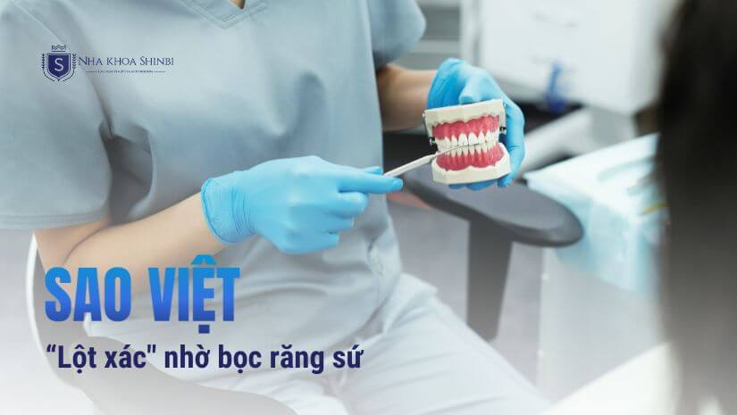 Điểm danh những sao Việt “lột xác” nhờ bọc răng sứ