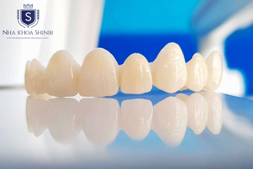 Sử dụng mão sứ trong quá trình niềng răng