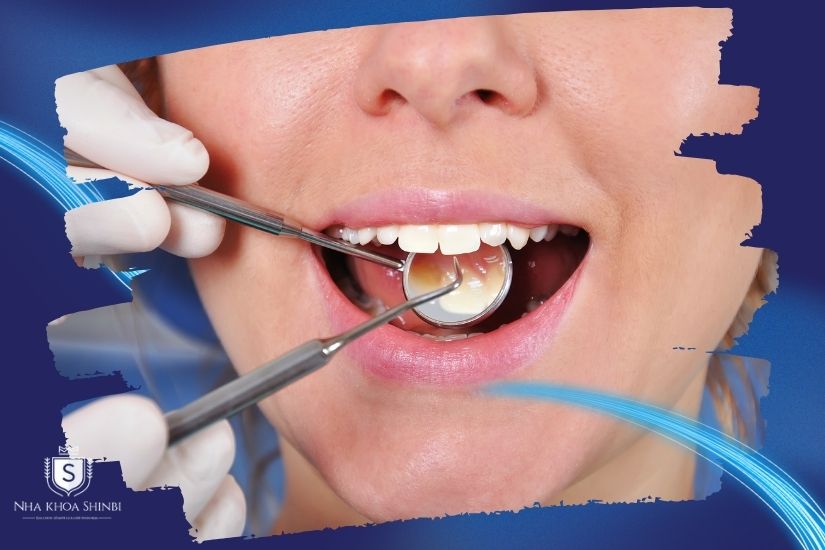 Khám và kiểm tra kỹ tình trạng răng miệng