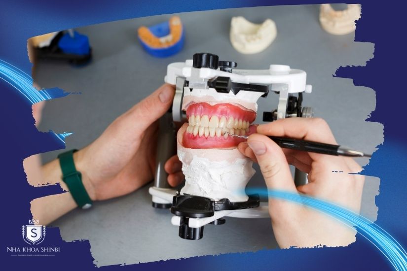 Chất lượng phòng labo chế tác răng