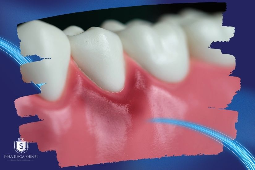 Tình trạng răng miệng ban đầu