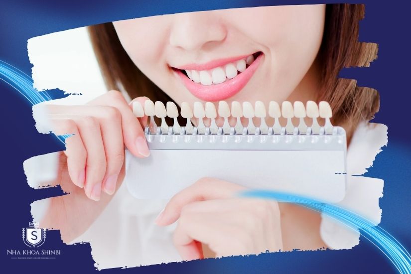Chất lượng thuốc tẩy trắng ảnh hưởng đến giá tẩy trắng răng tại phòng khám