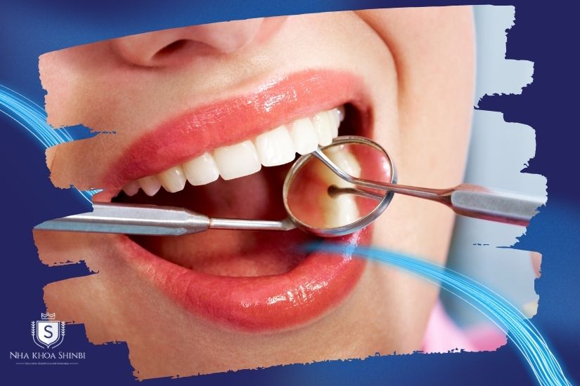 Đảm bảo an toàn cho răng miệng