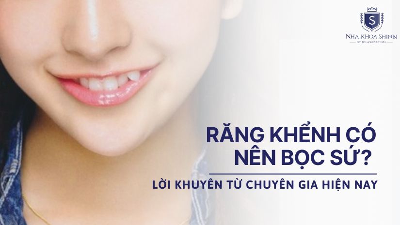 Răng khểnh có nên bọc sứ? Lời khuyên từ chuyên gia hiện nay