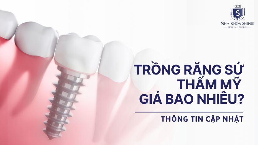 Trồng răng sứ thẩm mỹ giá bao nhiêu? Thông tin cập nhật
