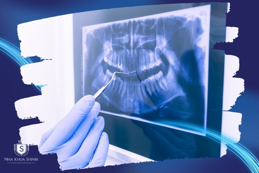 Công nghệ chụp răng hiện đại