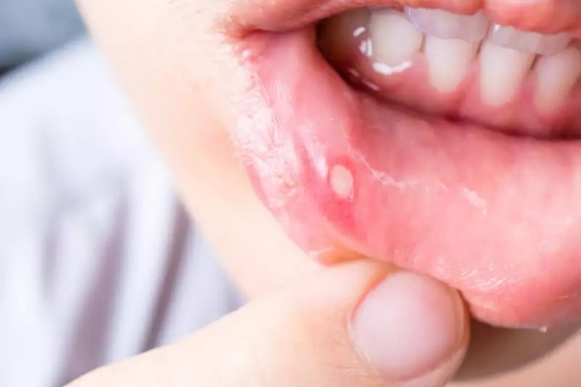 Ảnh hưởng của chu kỳ kinh khi làm răng
