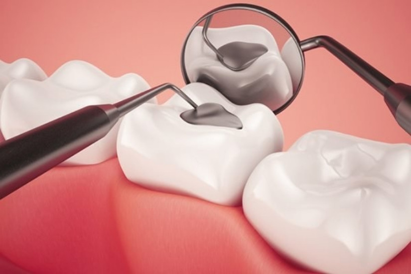 Ảnh hưởng của chu kỳ kinh khi làm răng