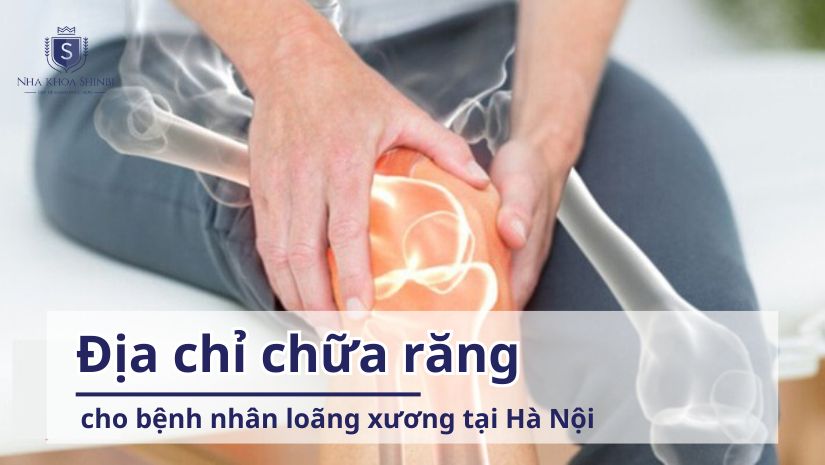 Địa chỉ chữa răng cho bệnh nhân loãng xương tại Hà Nội