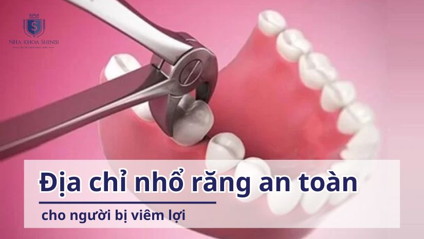 Địa chỉ nhổ răng an toàn cho người bị viêm lợi