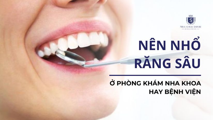 Nên nhổ răng sâu ở phòng khám nha khoa hay bệnh viện?