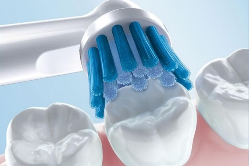 Nhổ răng ở người viêm lợi có cần làm sạch vùng viêm kỹ không?