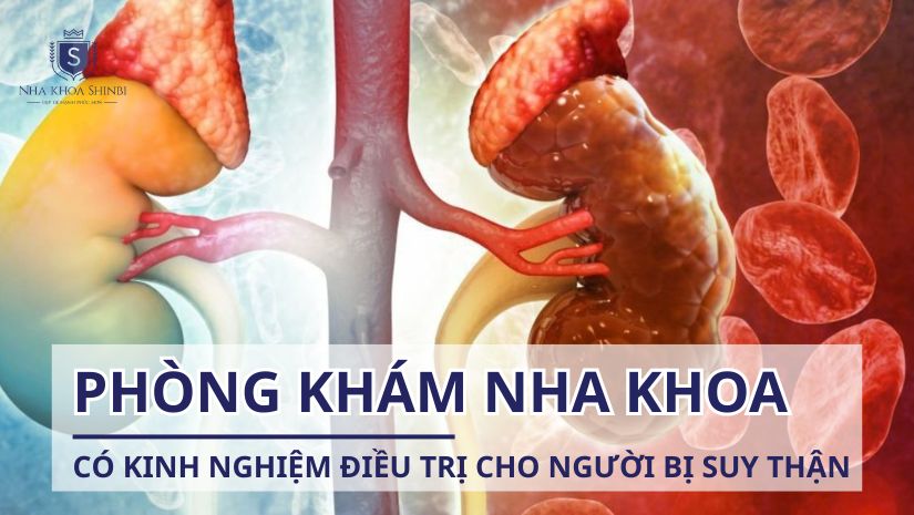 Phòng khám răng có kinh nghiệm điều trị cho bệnh nhân suy thận