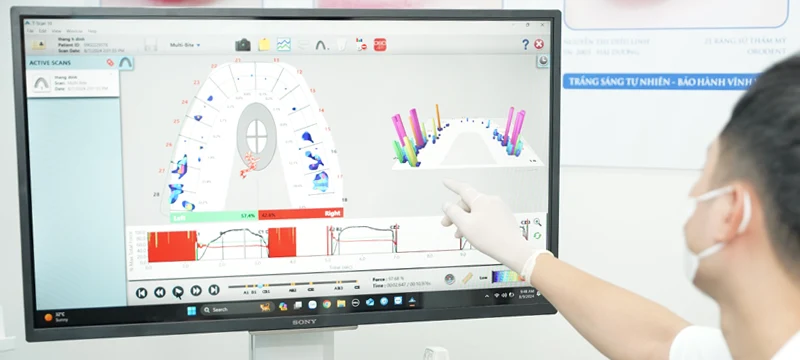 Ứng dụng công nghệ tái tạo xương hiện đại