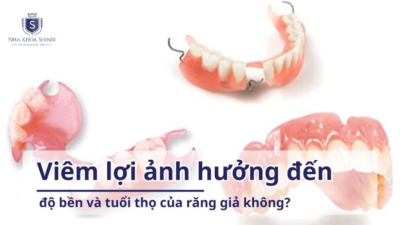 Viêm lợi ảnh hưởng đến độ bền và tuổi thọ của răng giả không?