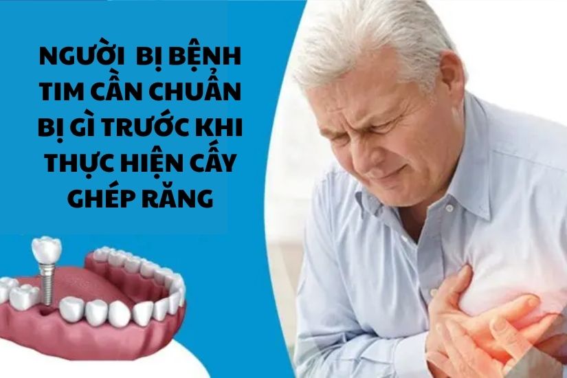 Người bệnh tim cần chuẩn bị gì trước khi thực hiện cấy ghép răng?