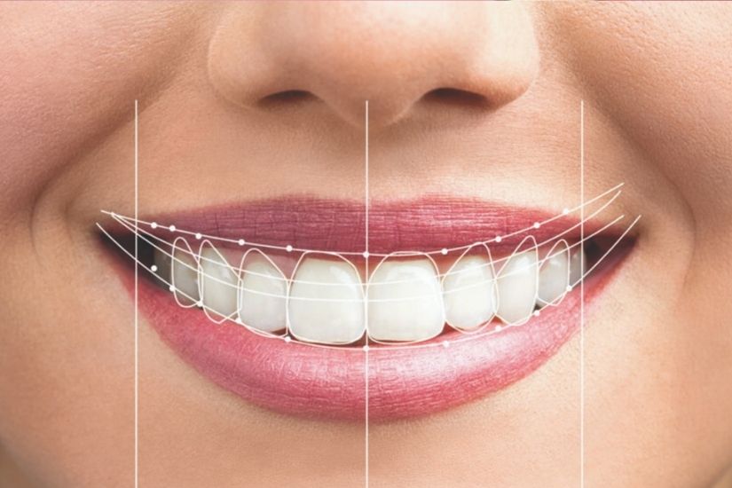 thiet-ke-nu-cuoi-voi-smile-design-3d thiet-ke-nu-cuoi-voi-smile-design-3d