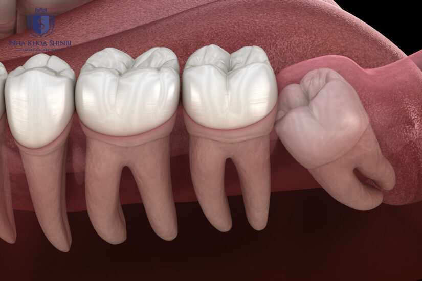 Công nghệ hiện đại giúp rút ngắn thời gian điều trị