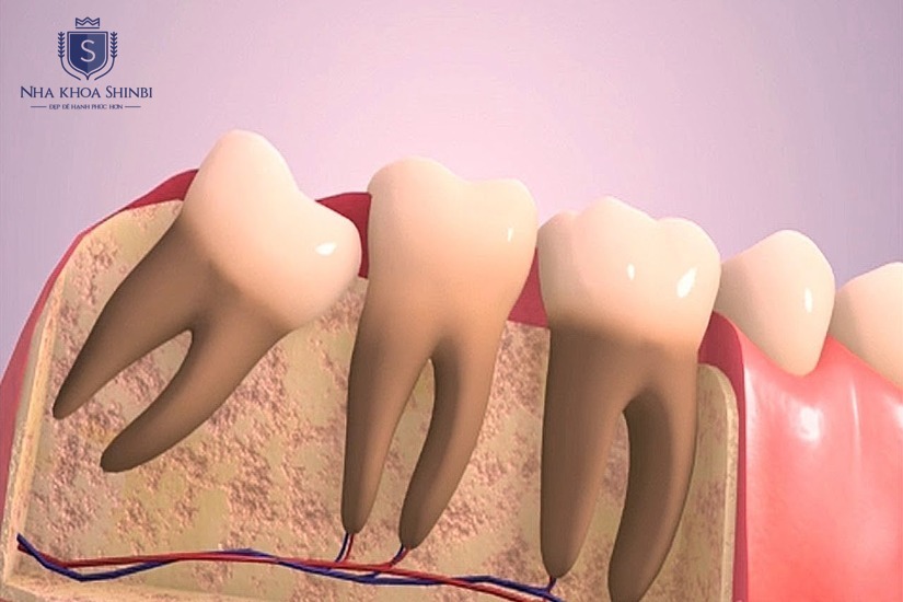 Giá cả rõ ràng đi kèm dịch vụ trọn gói