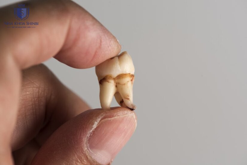 Các bước kiểm tra giúp bác sĩ đưa ra hướng điều trị phù hợp