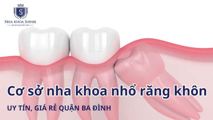 Cơ sở nha khoa nhổ răng khôn uy tín, giá rẻ quận Ba Đình