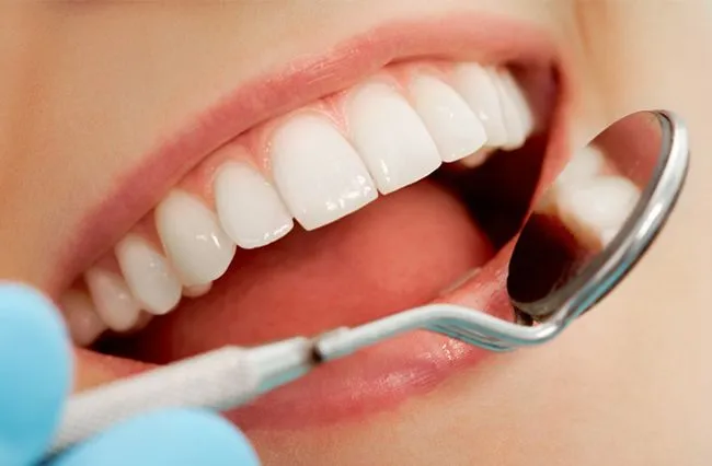 Bảng giá bọc răng sứ mới nhất tại Shinbi (2026) & Chính sách trả góp