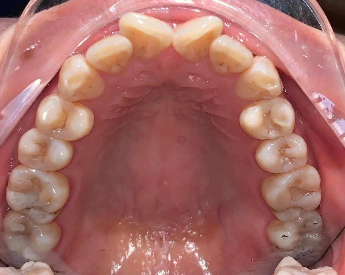 Yếu tố nào làm thay đổi chi phí niềng răng? (7 yếu tố quan trọng)