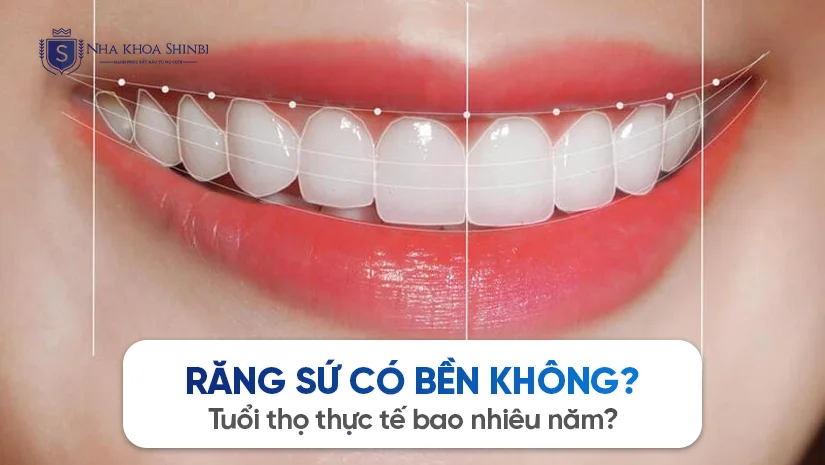 Răng sứ có bền không? Tuổi thọ thực tế bao nhiêu năm?