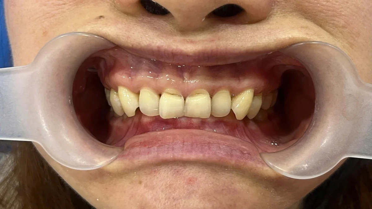Shinbi Dental - Nha khoa tốt gần Cổng Công viên Thống Nhất