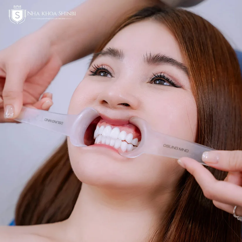 Shinbi Dental - Địa chỉ làm răng sứ đẹp khu vực Quang Trung