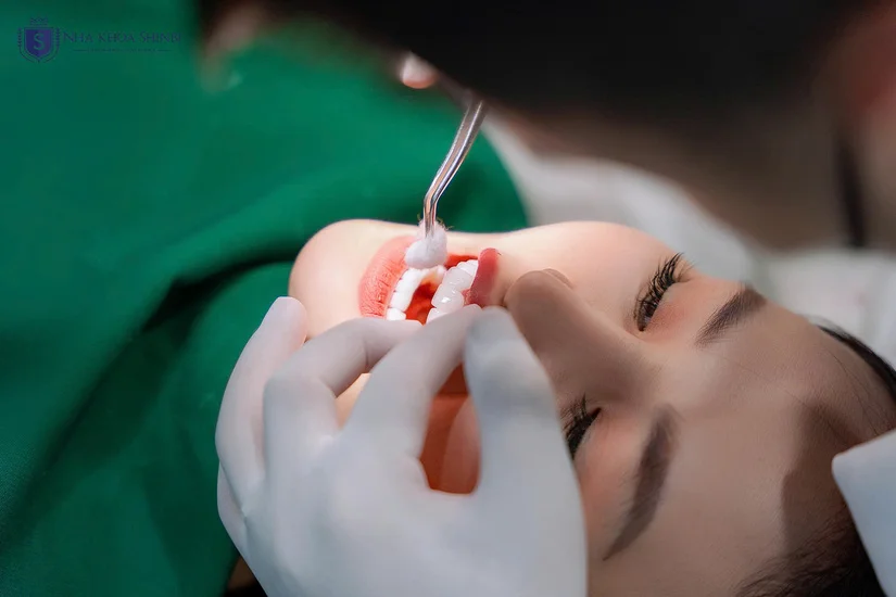 Tìm nha khoa uy tín trên phố Trần Quốc Toản, Hoàn Kiếm