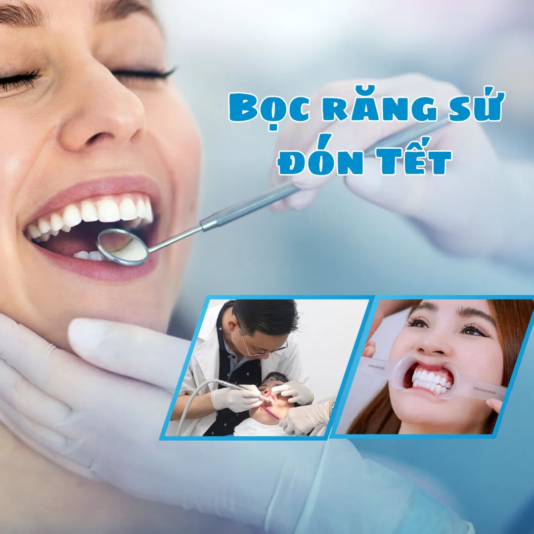 Vì sao cuối năm nhiều người chọn làm răng sứ