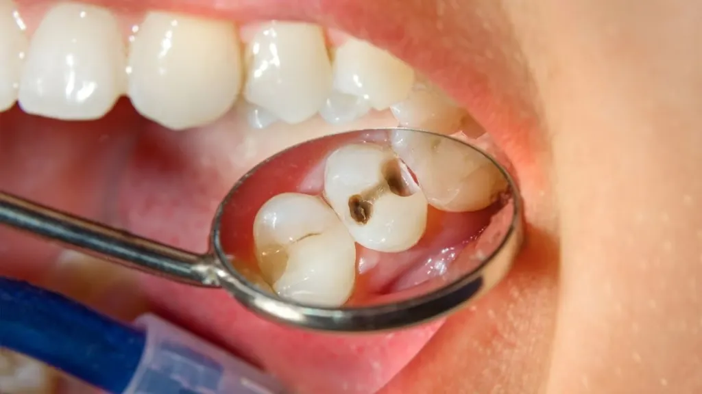 Địa chỉ bọc răng sứ Orodent chính hãng tại Trần Quốc Toản