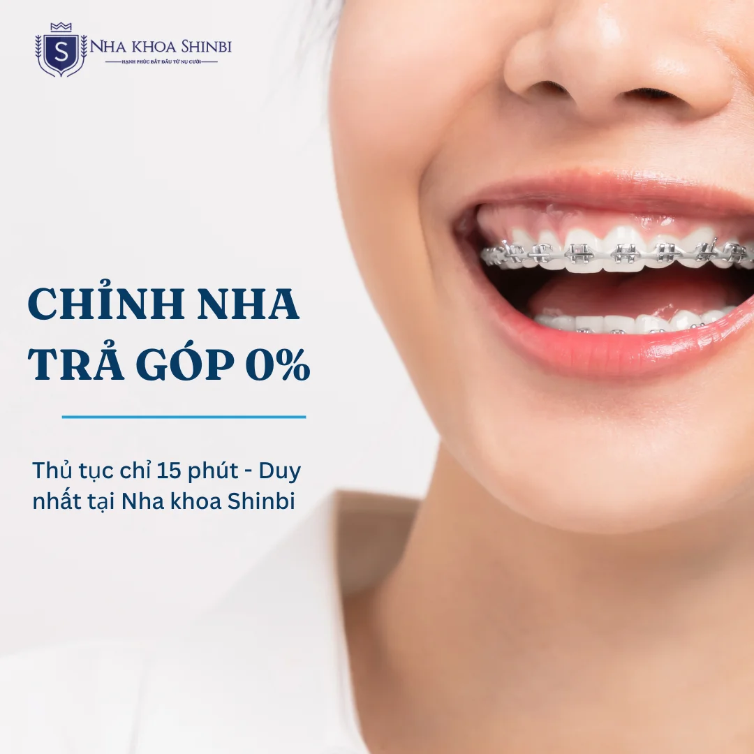 Chỉnh nha trả góp tại Hải Phòng: Duyệt hồ sơ nhanh 15 phút