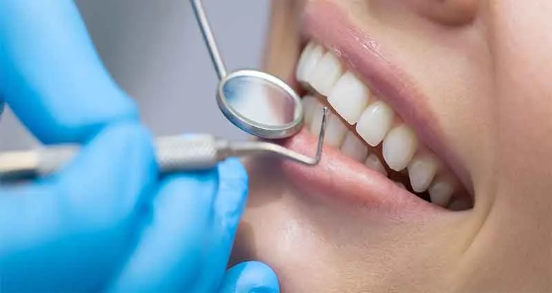 Dịch vụ dán sứ Veneer đẹp tự nhiên tại Shinbi Dental số 33 Trần Quốc Toản