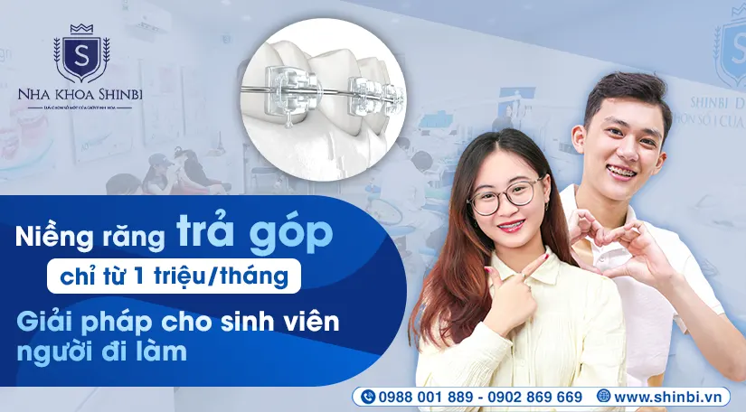 Niềng răng trả góp chỉ từ 1 triệu/tháng: Giải pháp cho sinh viên & người đi làm