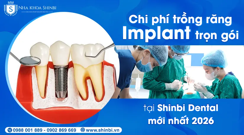Chi phí trồng răng Implant trọn gói tại Shinbi Dental mới nhất 2026