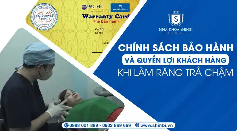 Chính sách bảo hành và quyền lợi khách hàng khi làm răng trả chậm