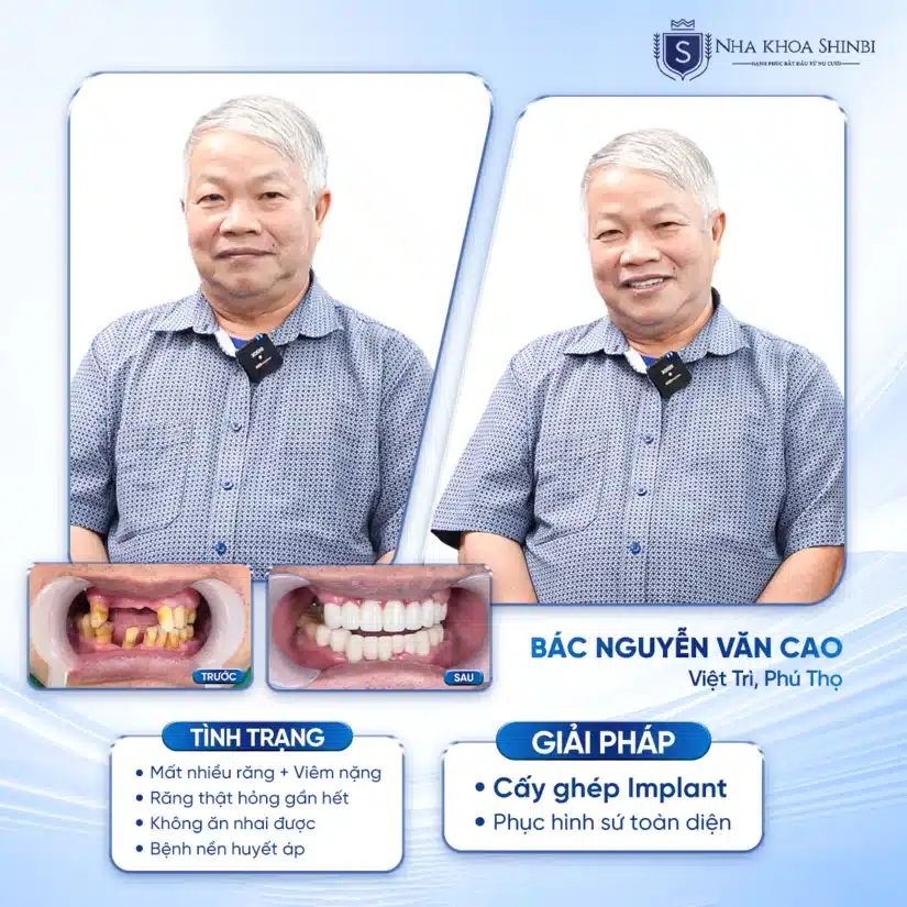 Shinbi Dental - Nha khoa tốt gần toà nhà Capital Tower / Prime Centre