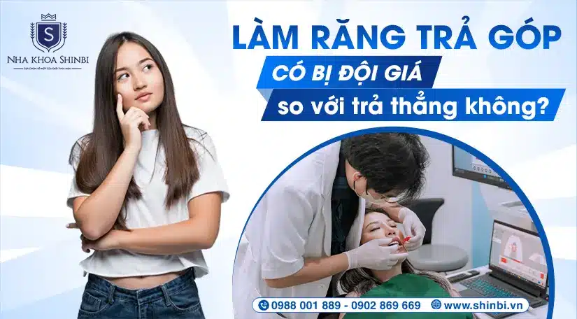 Làm răng trả góp có bị đội giá so với trả thẳng không?