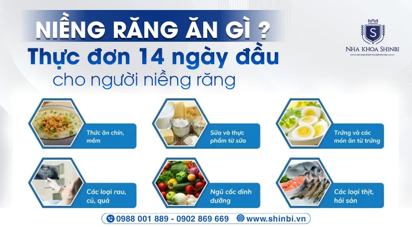 Niềng răng ăn gì? Thực đơn 14 ngày đầu cho người niềng răng