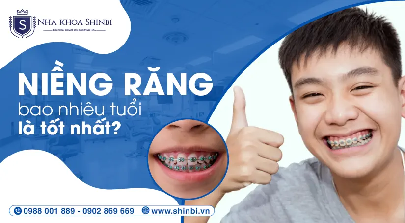 Niềng răng bao nhiêu tuổi tốt nhất? Mốc thời gian cho trẻ em & người lớn
