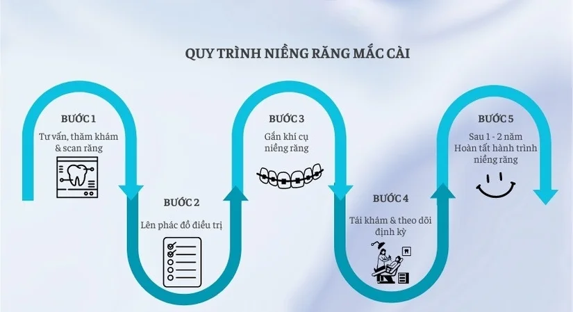 Niềng răng mắc cài tự buộc khác gì mắc cài thường?