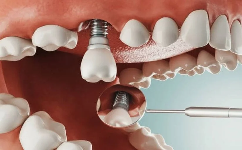Phòng khám răng hàm mặt uy tín khu vực Bà Triệu - Trần Quốc Toản
